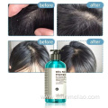 Oily Hair Shampoo For Greasy Hair